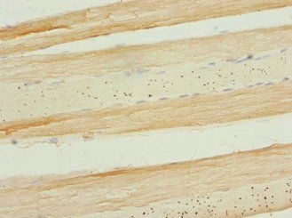 APIP Antibody