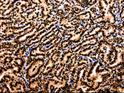APIP Antibody