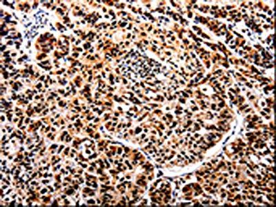 APIP Antibody