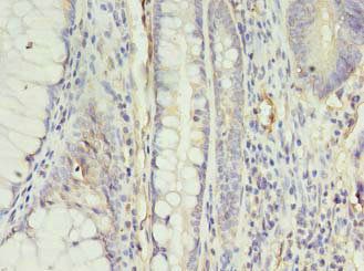 APLNR Antibody