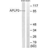 APLP2 (Ab-755) Antibody