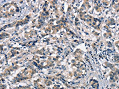 APOA1BP Antibody