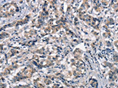 APOA1BP antibody