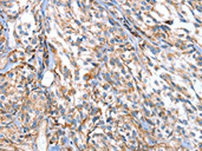 APOBEC3D Antibody