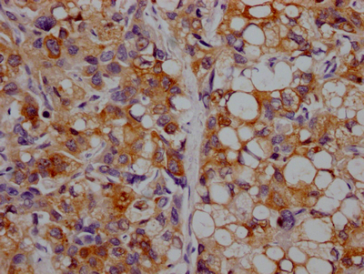 APOC3 Recombinant Monoclonal Antibody
