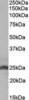 Goat anti-APOD Antibody