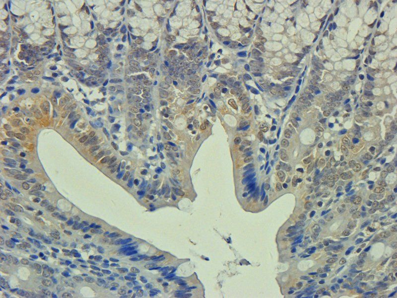 Apolipoprotein E antibody