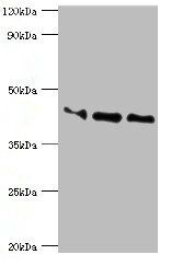 APOL1 antibody