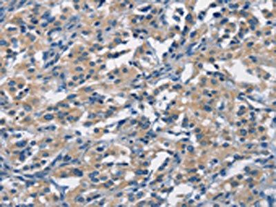 APOL1 antibody