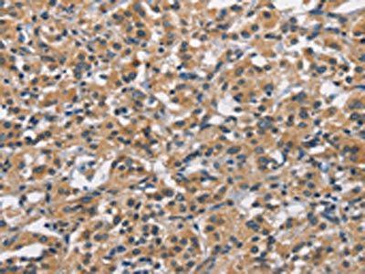 APOL1 Antibody