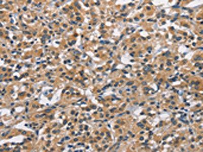 APOL1 antibody