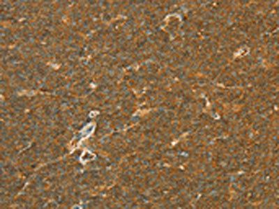 APOL2 Antibody