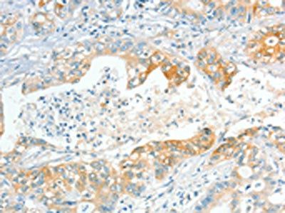 APOL2 Antibody