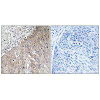 APOL2 Antibody