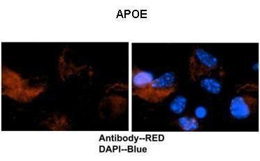 Apolipoprotein E antibody