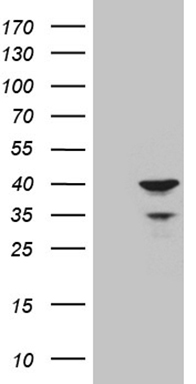Apolipoprotein L 1 (APOL1) antibody