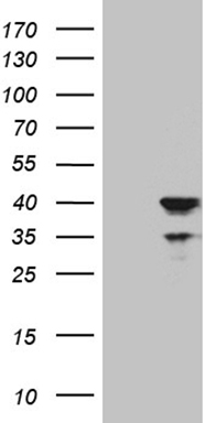 Apolipoprotein L 1 (APOL1) antibody