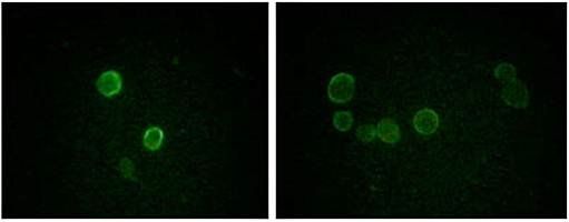 ApoM Antibody