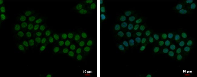 Apoptosis enhancing nuclease antibody