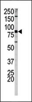 APP (phospho-Ser730) antibody