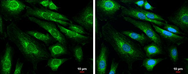 APP antibody [C2C3], C-term