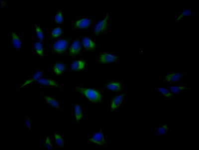 APP Recombinant Monoclonal Antibody