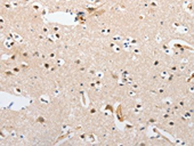APPBP2 Antibody