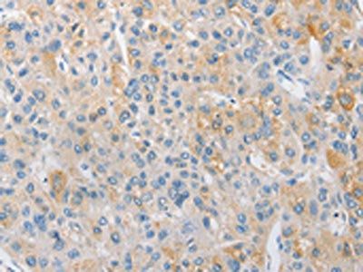 APPBP2 antibody