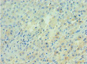 APRT Antibody