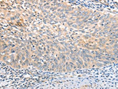 APTX Antibody
