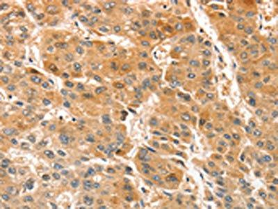 APTX Antibody