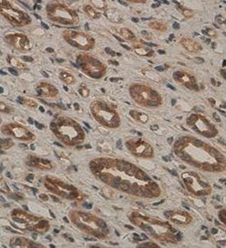 APXL Rabbit Polyclonal Antibody