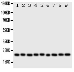 Cytoglobin/CYGB Antibody