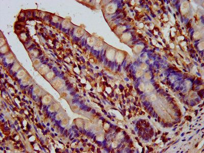 AQP10 Antibody