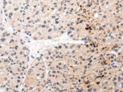 AQP11 antibody