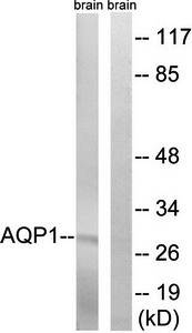 Aquaporin 1 antibody