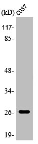 AQP2 antibody