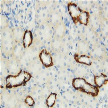 Anti-Aquaporin 3/AQP3 Antibody