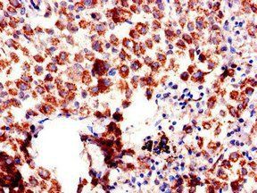 AQP6 Antibody