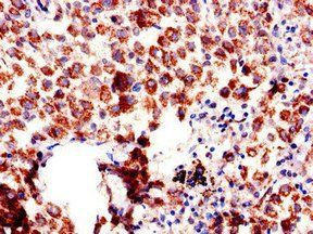 AQP6 antibody