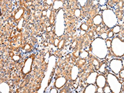 AQP7 Antibody