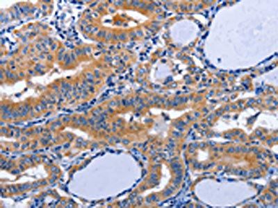 AQP8 Antibody