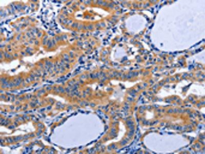 AQP8 antibody