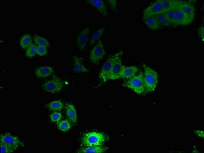 AQP1 Antibody