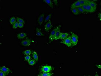 Aquaporin 1 antibody