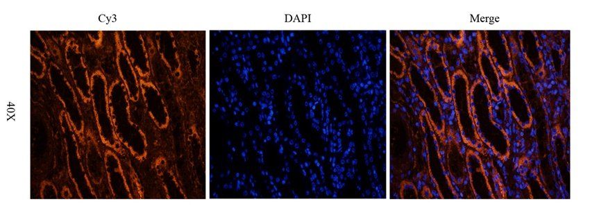 Aquaporin 2 antibody