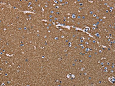 AQP4 Antibody