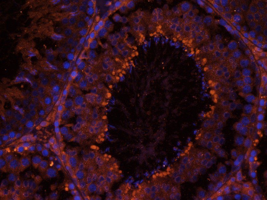 Aquaporin 7 Rabbit Polyclonal Antibody