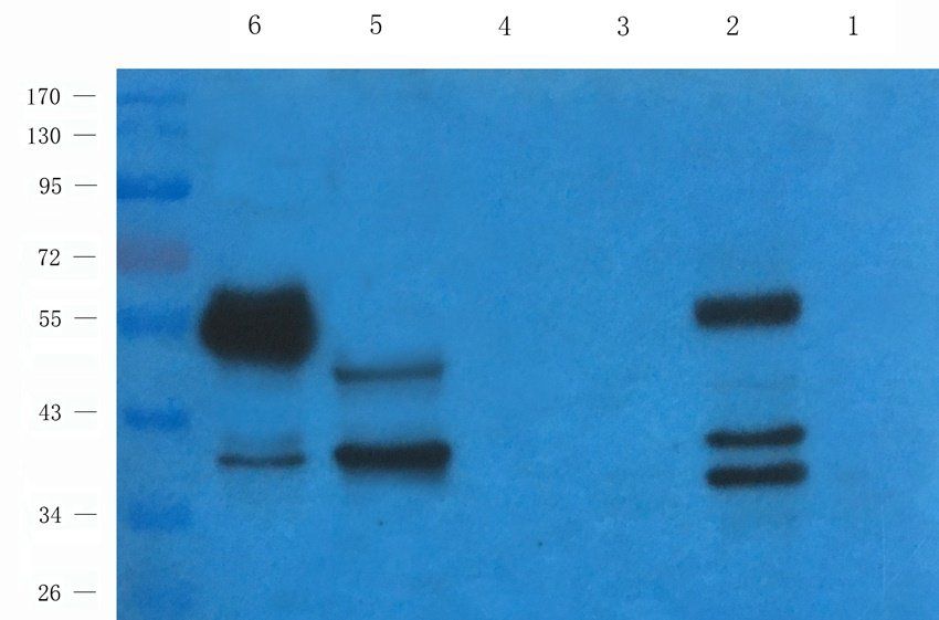 Aquaporin 7 antibody