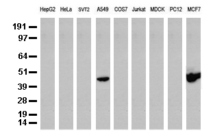 Aquaporin 8 (AQP8) antibody